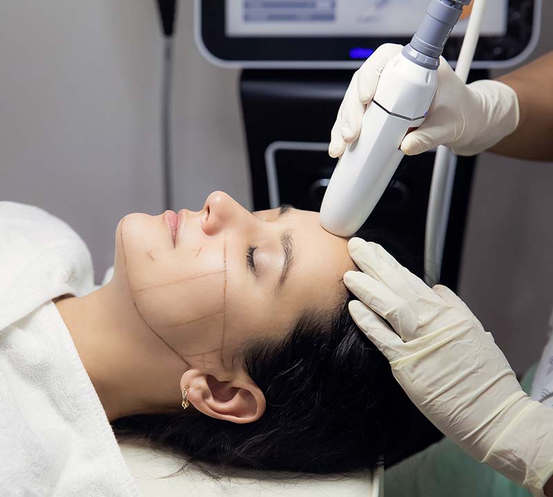 Woman receiving HUFU therapy